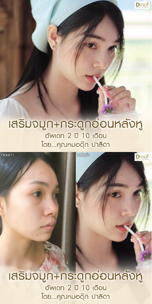 review8