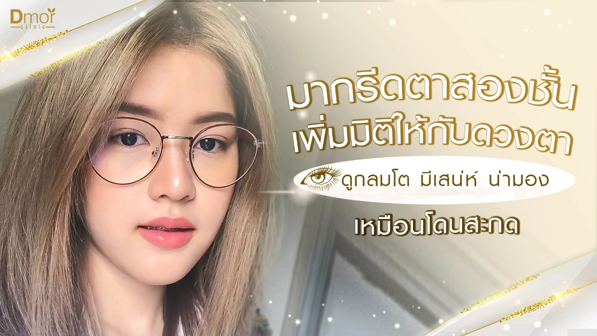 กรีดตาสองชั้น