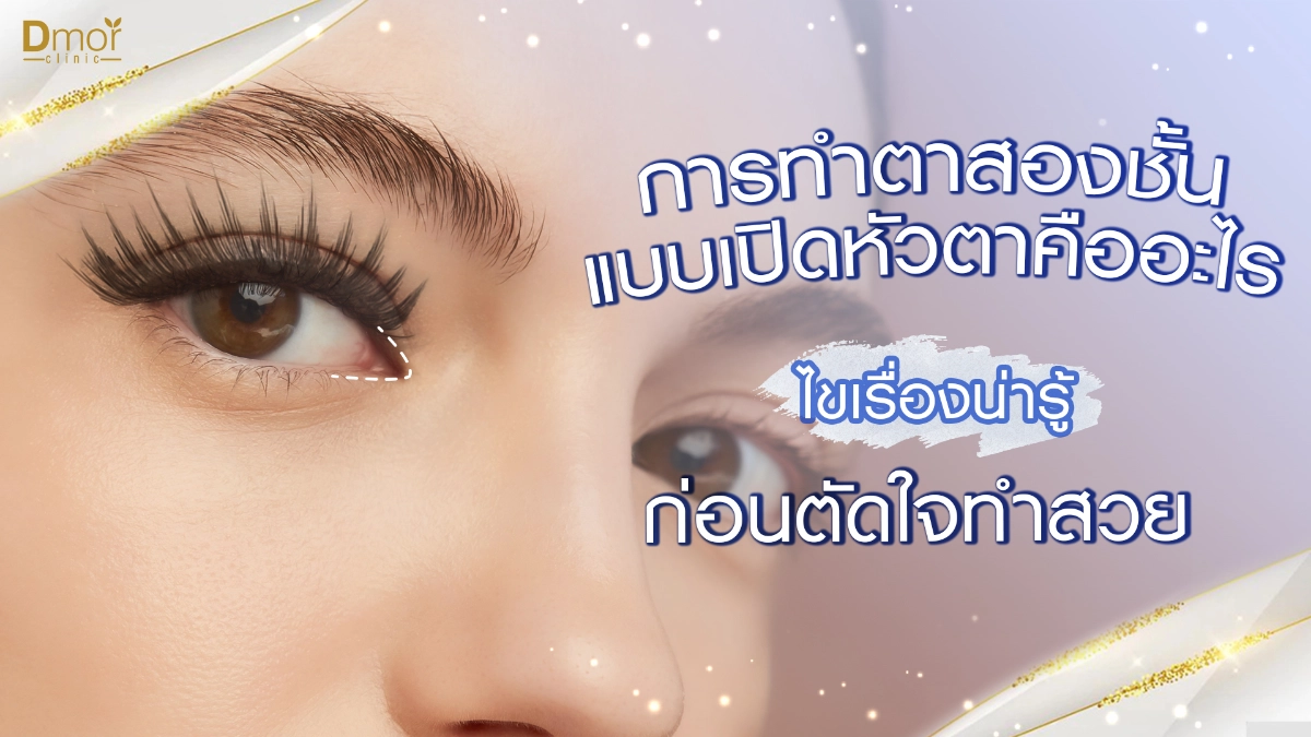 ทำตาสองชั้นแบบเปิดหัวตา_01