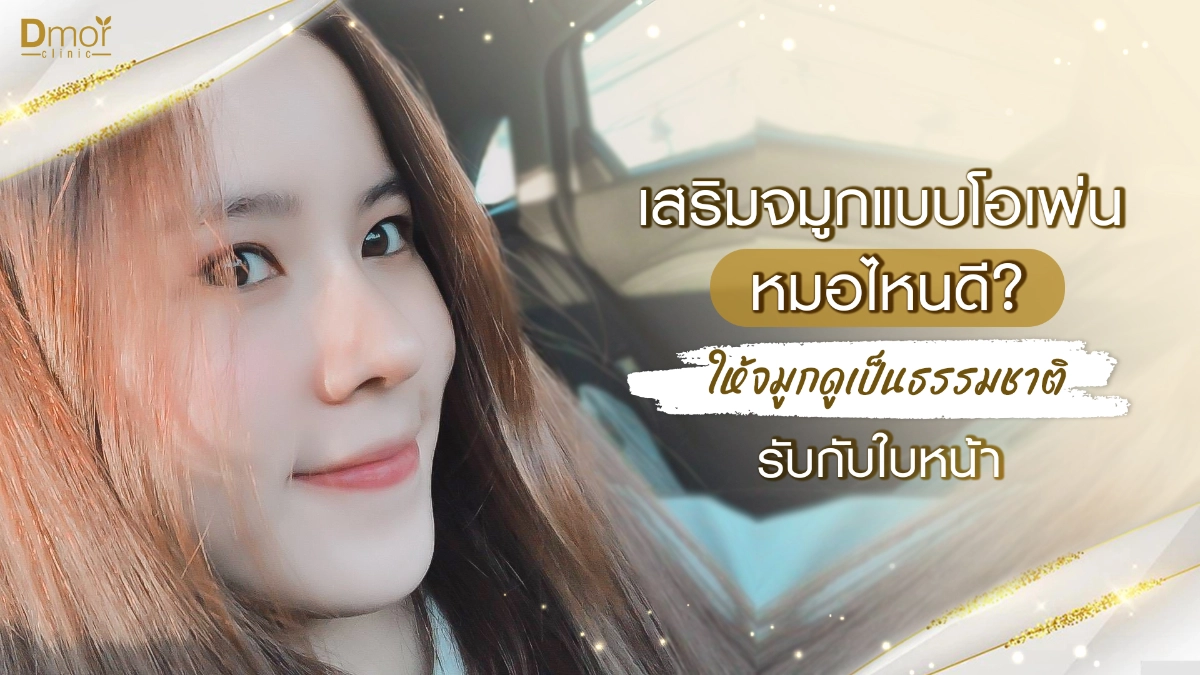 เสริมจมูกแบบโอเพ่น หมอไหนดี